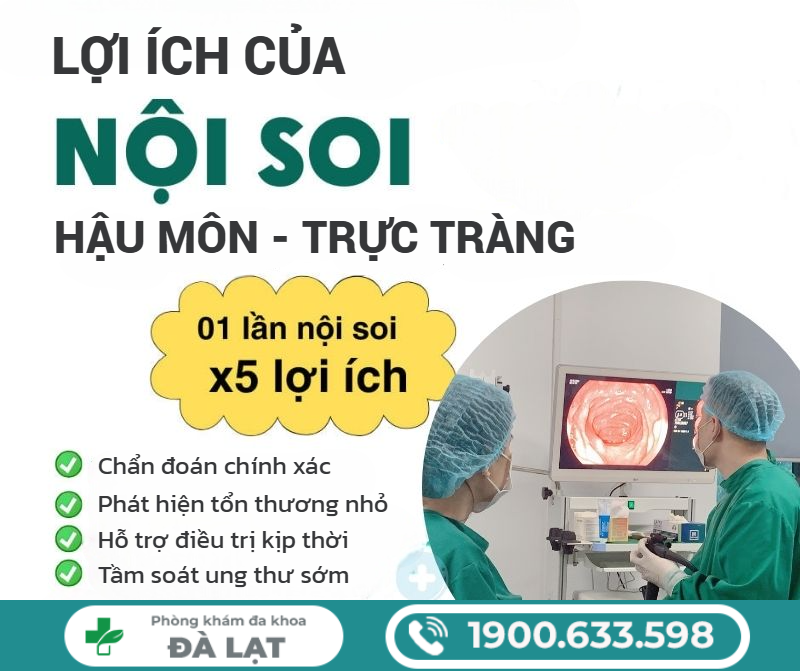 Hình ảnh minh họa